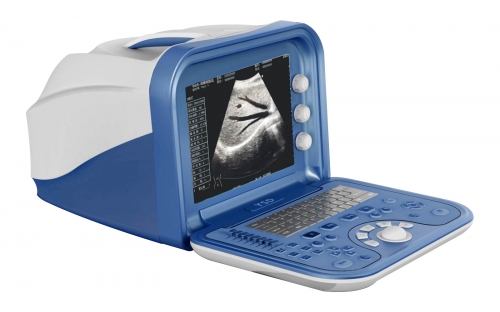 Ultrasound scanner YSD1205