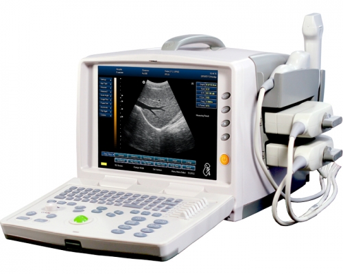 Full Digital Ultrasound Scanner YSD1300