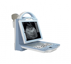 Laptop Ultrasound Diagnistic scanner YSD1208