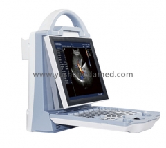 Laptop color doppler diagnostic ultrasound scanner YSD330