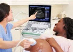 YSD4200B Hot Sale Mode Medical Device Ultrasound Scanner