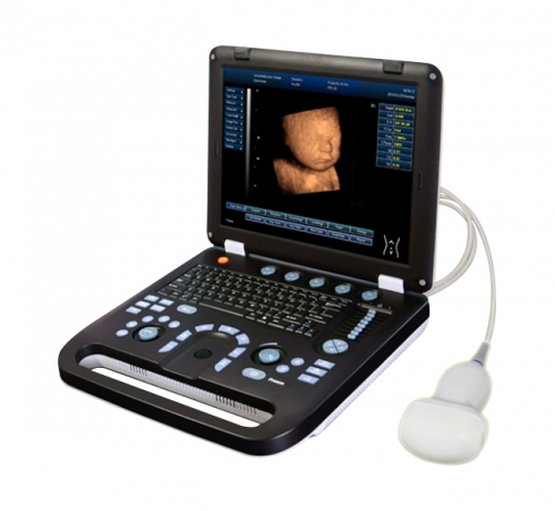 YSD4100A Digital Laptop Diagnosis Ultrasound System