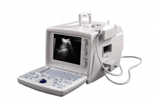 YSD1205A Full Digital Portable Ultrasound Scanner