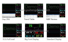 YSD16S Hospital Medical Diagnosis Device Patient Monitor