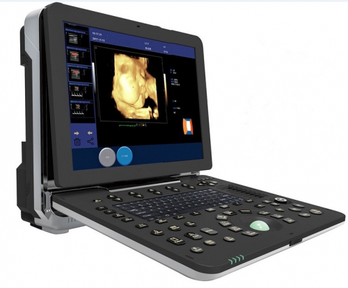 YSD522 4D color doppler Ultrasound scanner