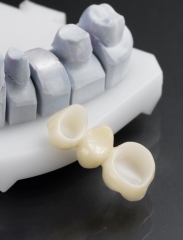 Zirconia Bridge