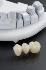 Zirconia Bridge