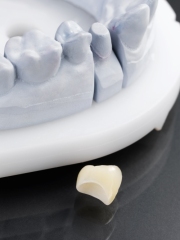 Zirconia Crown