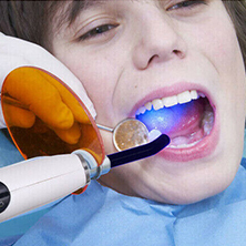 Curing Light