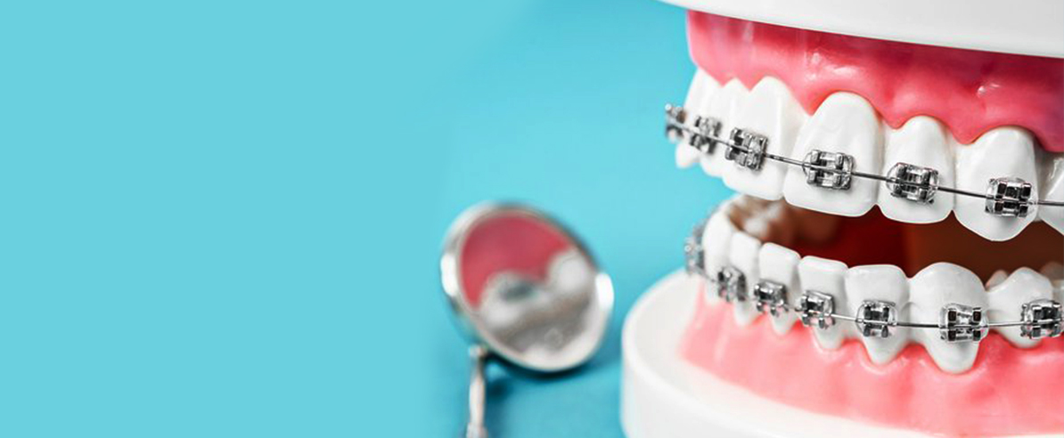 Dental Orthodontic Brackets Braces Mini Roth Slot.022 345 Hook