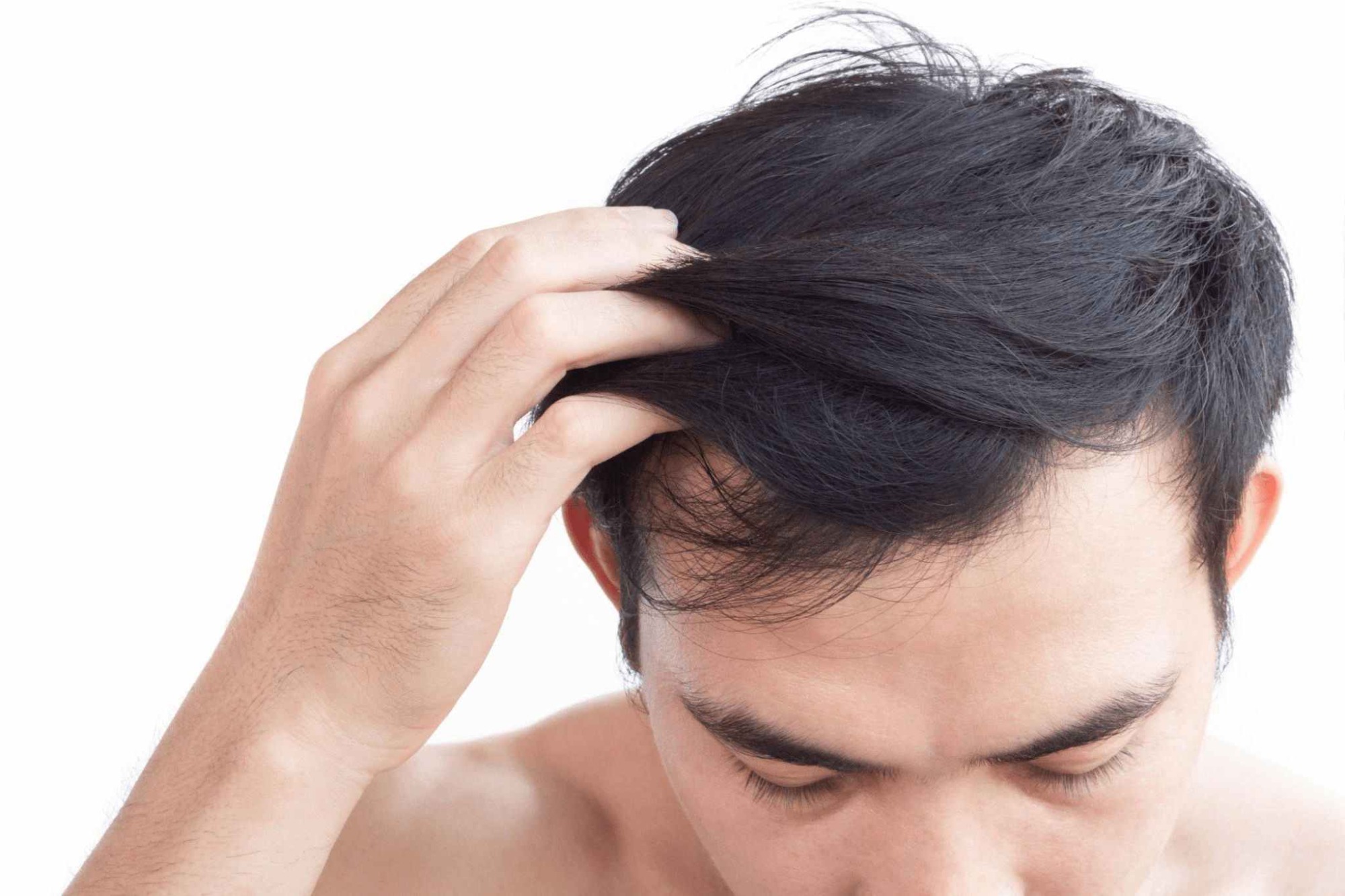 ¿No más calvo? Crecimiento del cabello con terapia de oxígeno hiperbárico