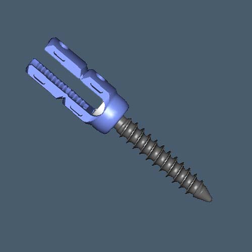 Spinal RS8-5.5 rod reduction Polyaxial Pedicle Screw