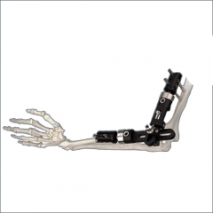 Orthopedic Elbow Fragment External Fixator