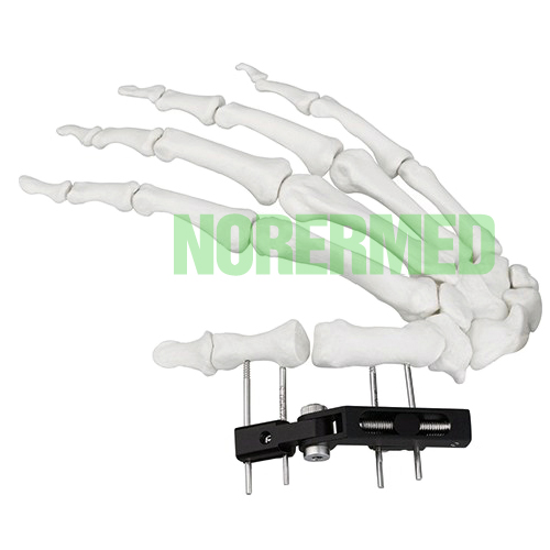 Mini Fragment External Fixator (Finger and Palm)- D Type