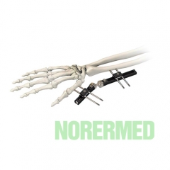 Orthopedic Wrist Joints External Fixator