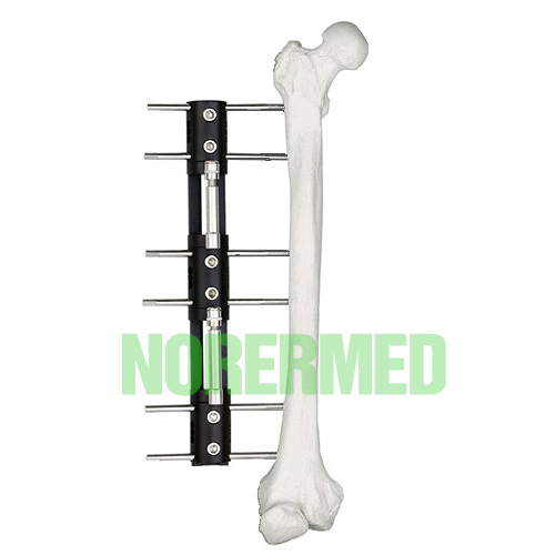 Bone Lengthening External Fixator – Type A