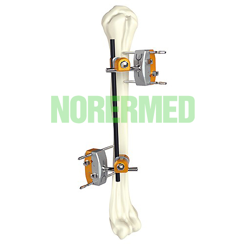 Orthopedic Hoffmann Humeral Shaft External Fixator