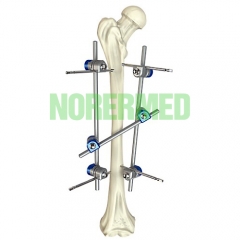 Orthopedic Hoffmann Femoral Shaft External Fixator