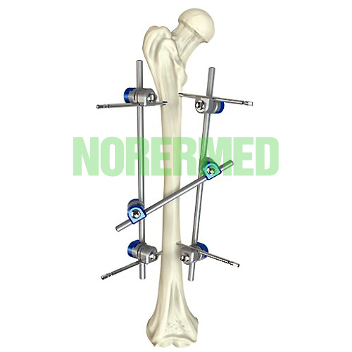 Orthopedic Hoffmann Femoral Shaft External Fixator