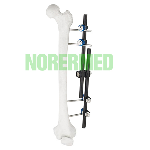 Orthopedic Straight Type Femur & Tibial External Fixator