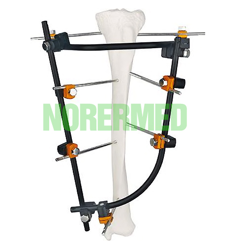 Orthopedic Tibial Joint External Fixator