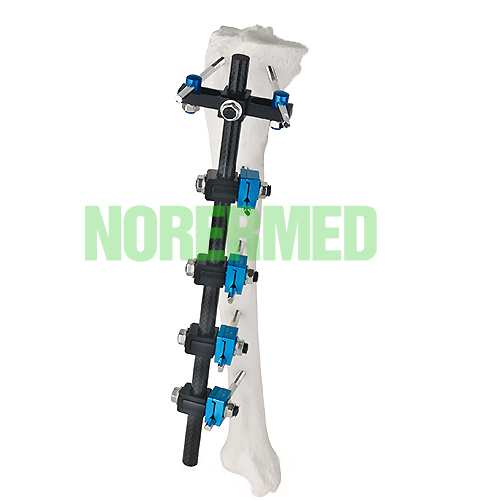 Orthopedic T type Tibial External Fixator