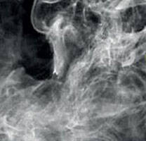 Analysis of smoking problem of polyethylene wax in the powder coating