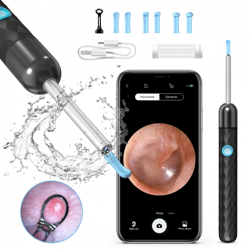 SUNUO X3 Visual Ear Cleaner and Acne Squeezing Otoscope