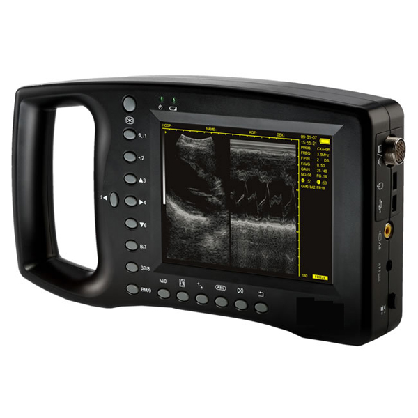 Ddigital Handheld EchographeYSB3100