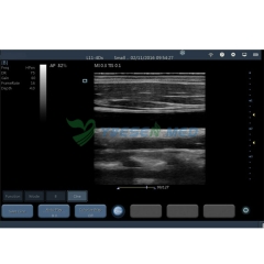 Wireless color ultrasound system