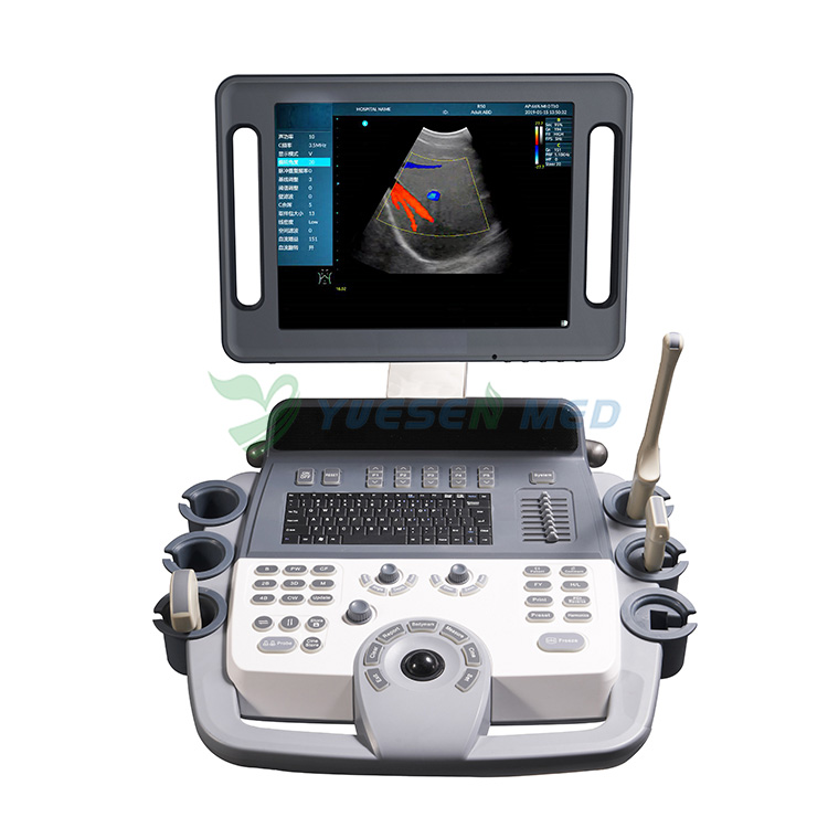 Système de diagnostic par ultrasons Doppler couleur entièrement numérique