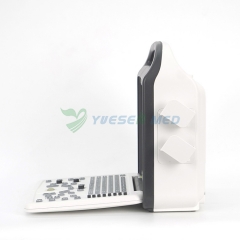 Ysb-Du10 Portable Color Doppler Ultrasound Machine