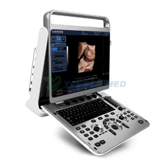 CHISON EBit 30 Portable Ultrasound Machine