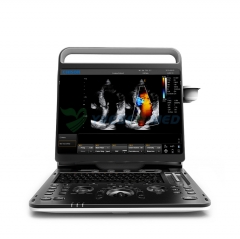 Scanner à ultrasons Doppler couleur 4D portable Chison Ebit 60