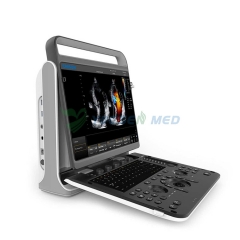 Chison Ebit 50 ultrasound color doppler ultrasound