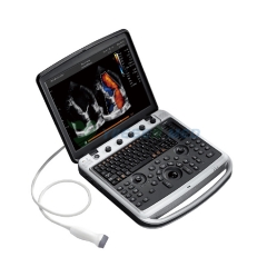 Puissant échographe Doppler couleur Sonobook