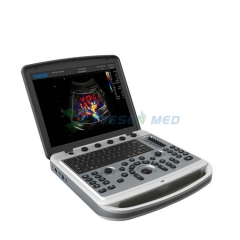 Chison Sonobook 9 Smart Laptop Ultrasound machine