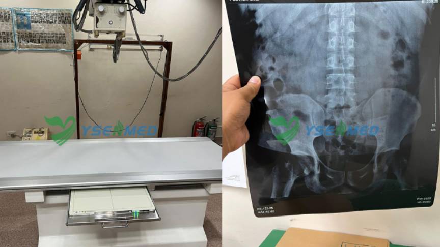 Le détecteur YSENMED DR YSFPD-M1717V facilite la numérisation des radiographies dans un hôpital philippin