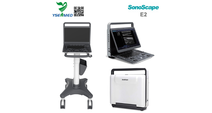 Doctor from El Salvador is happy with SonoScape E2 portable color doppler ultrasound