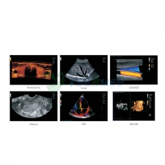 Cost Effective Portable 4D Color Doppler Ultrasound Scanner YSB-M70