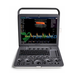 Portable Color Doppler Ultrasound 3D 4D Sonoscape S9 Pro