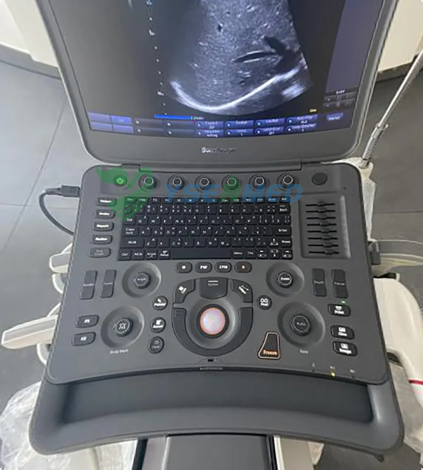 Un médecin du Venezuela est très satisfait de la qualité de l'image du SonoScape X3.