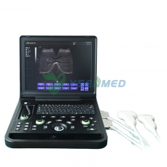 Échographe médical noir et blanc avec écran 15 pouces pour ordinateur portable YSB-SS7C
