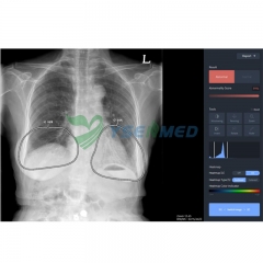 Logiciel de diagnostic IA pour la radiologie médicale thoracique YSX-AI-C