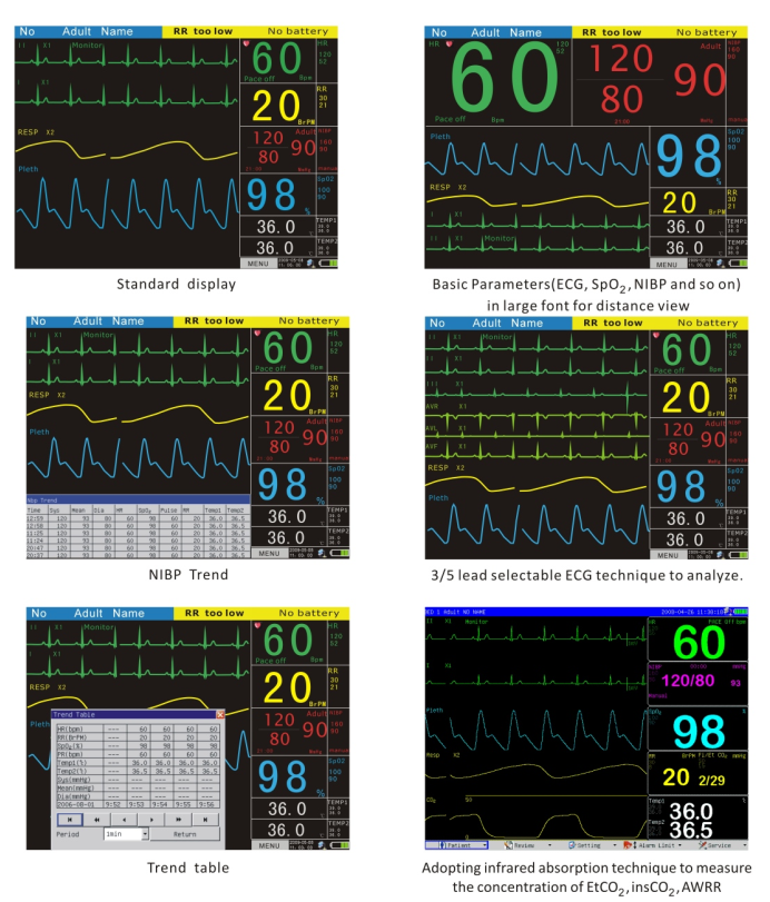 Haute Qualité 12.1 Pouces Multi-paramètre Patient Moniteur YSF8