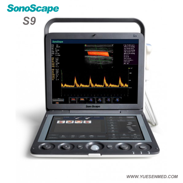 3D 4D color doppler ultrasound sonoscape s9
