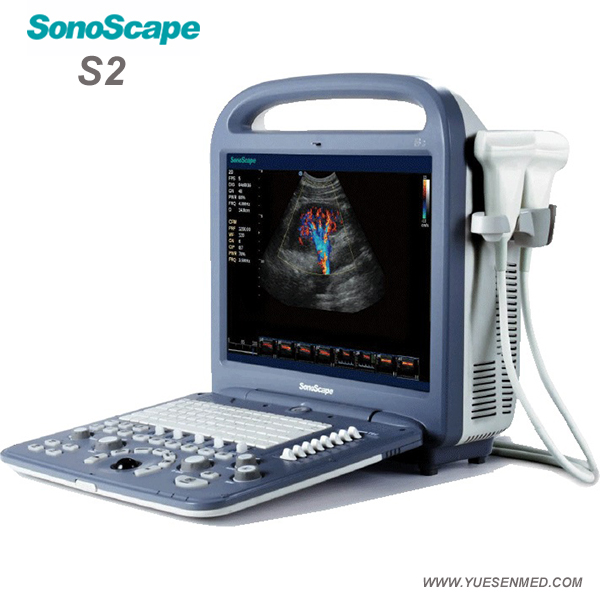 Sonoscape Portable Color Doppler Ultrasound S2 For Sale
