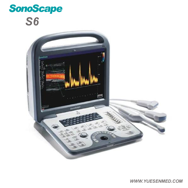  Sonoscape Portable Color Doppler Ultrasound S6 Price