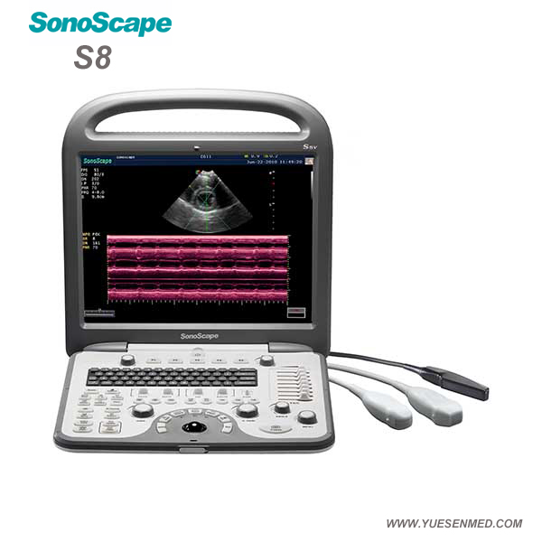 Couleur Portable vétérinaire échographie Doppler S8V Sonoscape