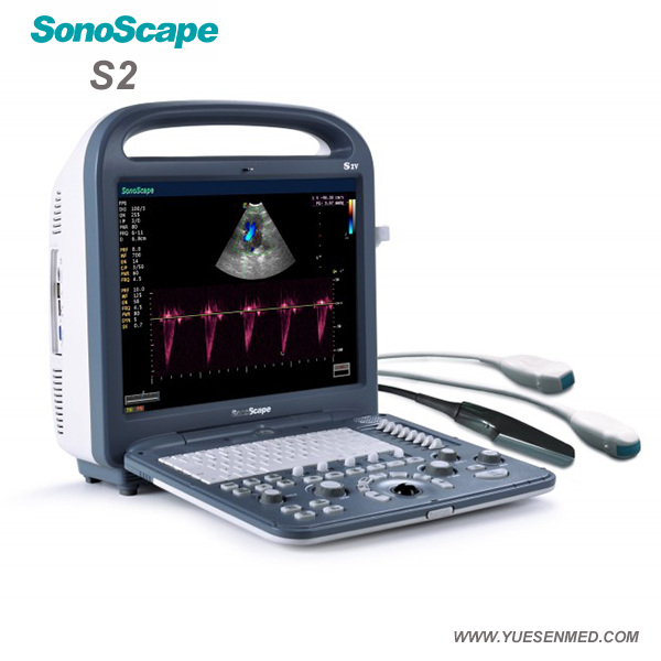 Sonoscape portatif ultrasons S2 Doppler couleur